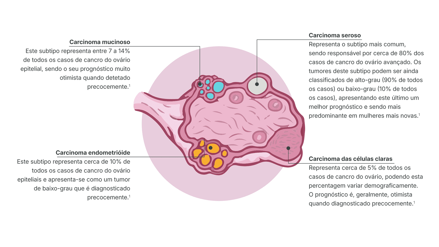 Cancro epitelial