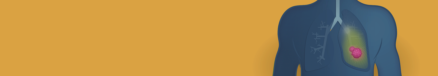 Banner do Cancro do Pulmão